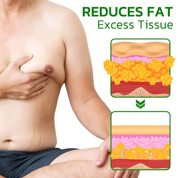 GFOUK TurmericMax Gynecomastia Compress Patch